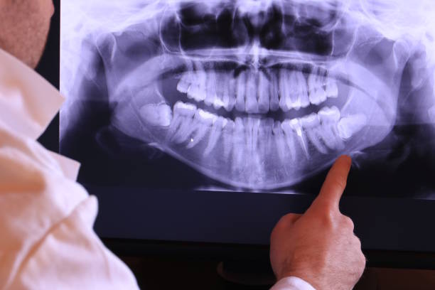 Best Emergency TMJ Treatment in North St Paul, MN
