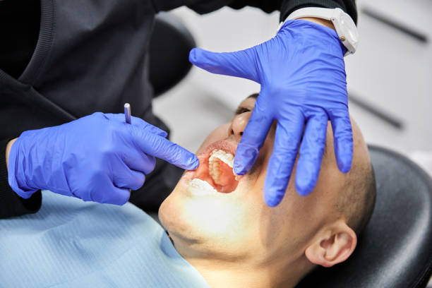 Best Emergency Tooth Extraction in North St Paul, MN